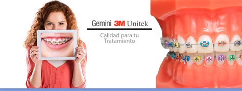 brackets mbt metalicos|brackets gemini de 3m.